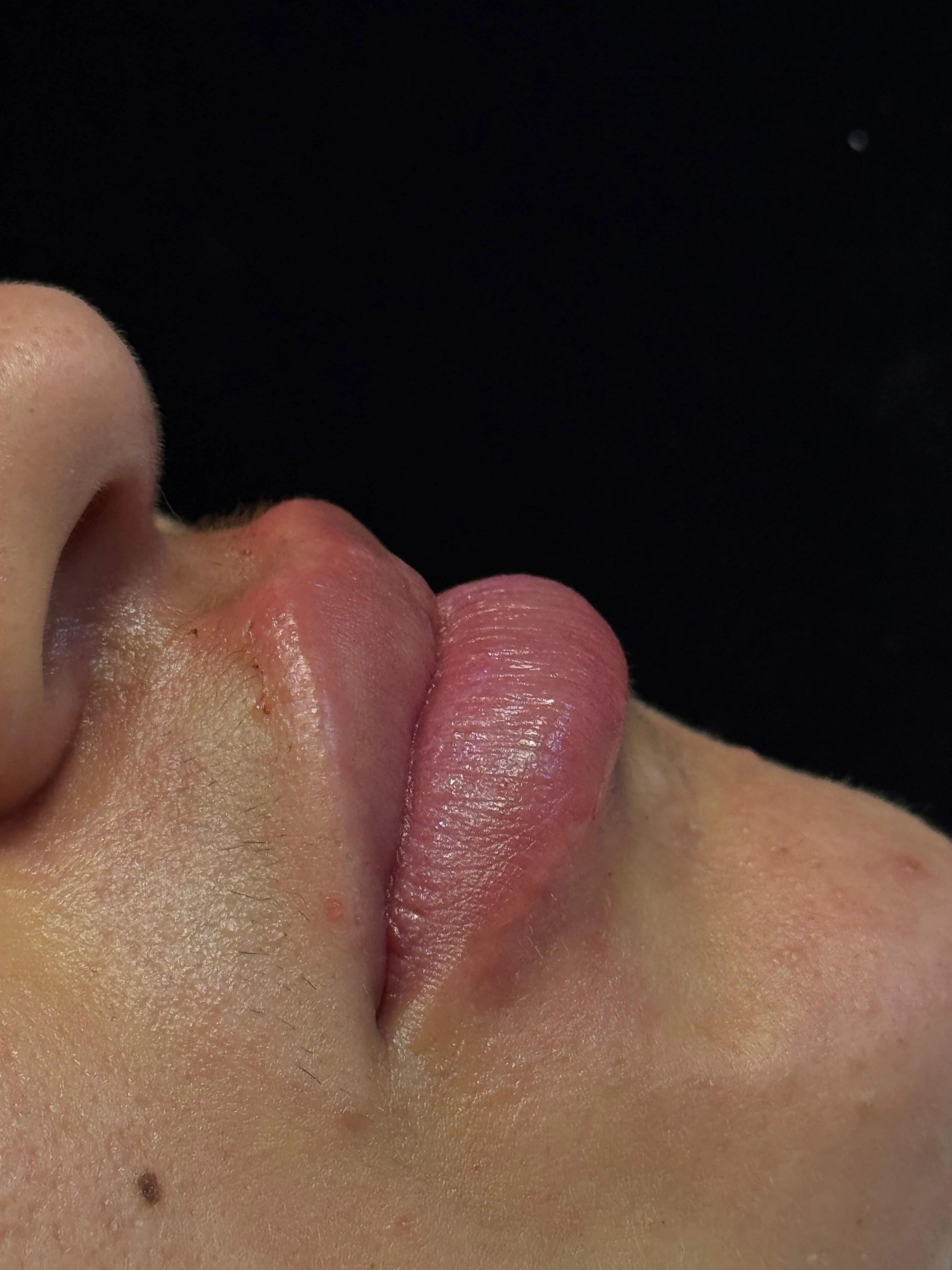 Harmonização Orofacial